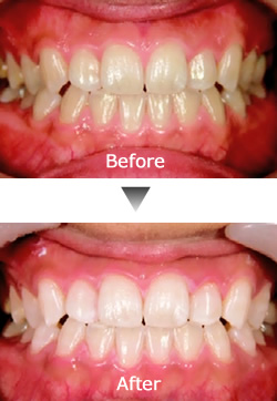 素敵な笑顔、輝く白い歯、美しい歯並びを実現しませんか？